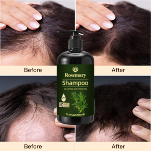 Juego de champú y acondicionador de árbol de té para el crecimiento del cabello de menta de Romero orgánico natural de fábrica OEM - Product Image 3