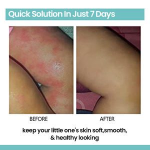 Label privé Soins naturels pour bébés et enfants Soin bio pour la <span class=keywords><strong>peau</strong></span> apaise les démangeaisons Crème pour <span class=keywords><strong>peau</strong></span> sèche - Product Image 3