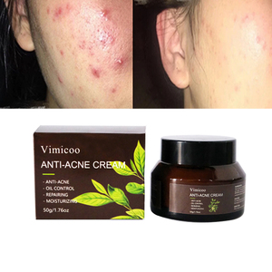 Tùy Chỉnh Nhãn Hàn Quốc Chăm Sóc Da Giữ Ẩm Nhẹ Nhàng Sửa Chữa Da Bị Tổn Công Tổn Thiện Hàng Rào Loại Bỏ Mụn Trứng Cá Salicylic Axit Mặt Kem - Product Image 1