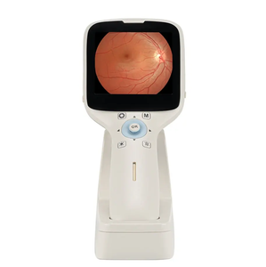 Taşınabilir yüksek çözünürlüklü HFC-1 Model el göz Fundus kamera veteriner optik dijital oftalmik enstrüman ekipmanları - Product Image 4