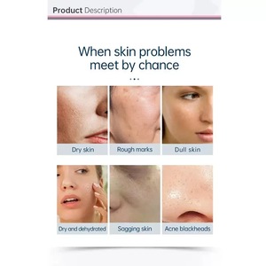 Nouvelle machine Hydra 6 en 1 pour microdermabrasion, oxygène et nettoyage en profondeur, avec tête en acier inoxydable, portable pour usage en salon - Product Image 6