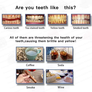 <span class=keywords><strong>Pasta</strong></span> <span class=keywords><strong>de</strong></span> <span class=keywords><strong>Dientes</strong></span> Morada para Blanquear los <span class=keywords><strong>Dientes</strong></span>, Cuidado Bucal, <span class=keywords><strong>Pasta</strong></span> <span class=keywords><strong>de</strong></span> <span class=keywords><strong>Dientes</strong></span> Vegana OEM, Producto para el Mal Aliento - Product Image 3