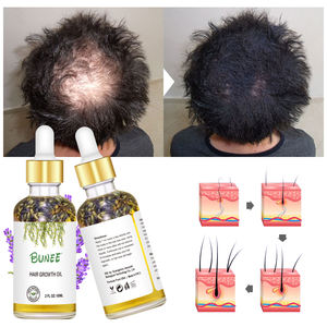 Aceite de botina de suero para el crecimiento del cabello de ricino antipérdida de cabello de etiqueta privada para mujeres negras - Product Image 1