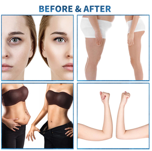 Rouleau de massage pour le corps Endosphere, pour le remodelage du corps, la perte de poids, le resserrement de la peau, portable - Product Image 5