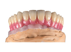 Materiali Protesici in Zirconia Multistrato 3D Zirdent per Faccette Dentali e Corone, Certificati CE e ISO13485 Classe II per Uso <span class=keywords><strong>CAD</strong></span> <span class=keywords><strong>CAM</strong></span> - Product Image 6