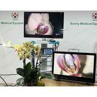 Sistema de cámara de endoscopia UHD Ultra HD profesional de gama alta, cámara endoscópica médica para cirugía veterinaria,