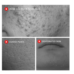 Tónico Facial Hidratante y Humectante <span class=keywords><strong>de</strong></span> Marca Privada para el Cuidado Natural <span class=keywords><strong>de</strong></span> la Piel, con <span class=keywords><strong>Agua</strong></span> <span class=keywords><strong>de</strong></span> <span class=keywords><strong>Rosas</strong></span> Pura y Vitamina C - Product Image 5