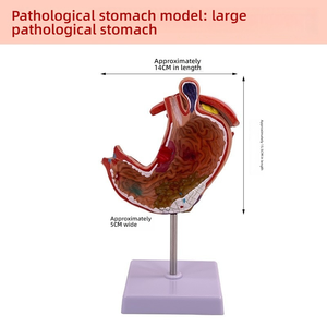 Modelo <span class=keywords><strong>de</strong></span> anatomía educativa <span class=keywords><strong>de</strong></span> Gastroenterología, sección coronal ampliada <span class=keywords><strong>de</strong></span> PVC, perforación patológica del estómago para la ciencia médica - Product Image 4