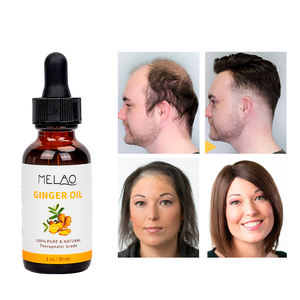 Huile de gingembre pure à 100 % pour la croissance des cheveux, hydratante et drainante pour le ventre, huile essentielle de gingembre de Chine, huile de gingembre OEM, marque privée - Product Image 6