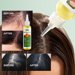 Aceite de BATANA Orgánico de Marca Privada para el Cuidado del Cabello, Acondicionador Botánico para el Cuero Cabelludo, Favorece el Crecimiento - Product Image 2