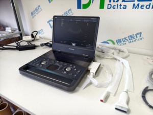 Sistema de Diagnóstico de Ecocardiografía Doppler a Color Portátil SonoScape E11 Propet, Precio del Ultrasonido Veterinario - Product Image 1
