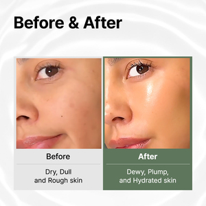 Ampolla Facial Hidratante Premium con 82% de Agua de Té Verde de Jeju, Spray Facial Antioxidante de Larga Duración para una Piel Radiante, 125ml para Uso Diario - Product Image 4