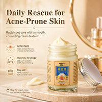 Crème pour le visage contre l'acné, élimine les marques d'acné, resserre les pores, adoucit et lisse la peau, améliore la peau acnéique, crème de soin du visage, crème de soin de la peau
