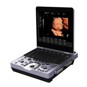 Ecógrafo Portátil Veterinario DMU83 de Diseño Moderno con Pantalla HD de 15.6 Pulgadas para Clínica y Hospital - Product Image 5