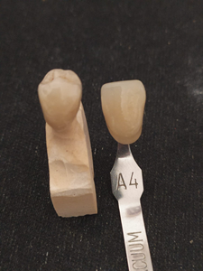 Tandheelkundige Keramische Kunstgebit Tandheelkundige Zirkonia Blanks Circonio Dentale - Product Image 6