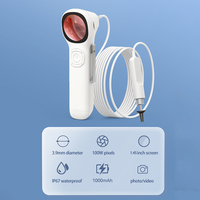 Otoscope intelligent haute définition portable pour usage domestique, appareil d'inspection visuelle pratique pour les oreilles