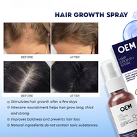 Spray d'essence pour la croissance des cheveux, marque privée, fabrication OEM, pour adultes