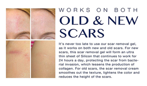 Good Effect Medical-Grade Silicone Scar Removal Gel Private Label <b>Clear</b> Acne Face Skin Smooth Scar Gel <b>Tape</b> for Skin Care - Product Image 6