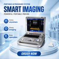 Vente en gros - Promotion exceptionnelle : Échographe Doppler Couleur Portable avec options de sondes Convexe et Linéaire pour usage Commercial et Domestique