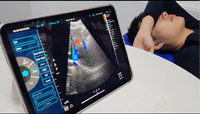 Échographe Doppler couleur sans fil Konted DYX10RL, appareil à ultrasons portable, équipement optique électronique vétérinaire