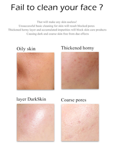 RubioAroma <span class=keywords><strong>Meilleur</strong></span> Nettoyant Visage Moussant Naturel Biologique Vegan aux Acides Aminés pour Peaux Sèches, Éclaircissant, Blanchissant, Anti-Acné et Hydratant - Product Image 6