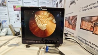 Caméra d'endoscopie médicale portable Full HD 19'' avec source lumineuse intégrée pour ORL et urétéroscopie
