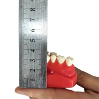 Modelo de implante dental: modelo de entrenamiento dental de alta fidelidad para educación y práctica de Implantología