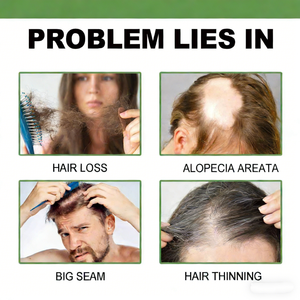 <span class=keywords><strong>Spray</strong></span> de repousse des cheveux de qualité professionnelle pour salon, traitement hydratant intensif, sérum unisexe, activateur de follicules pileux pour tous les types de cheveux - Product Image 4