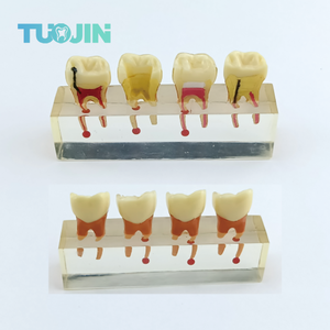 Modello Didattico Dentale Trasparente per Pratica Radicolare, Modello di Denti con Malattie per Studio e Trattamento Endodontico - Product Image 1