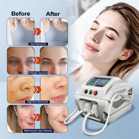 Appareil IPL de rajeunissement cutané et d'épilation permanente pour salon, certifié CE 510K, avec filtres multiples, personnalisable