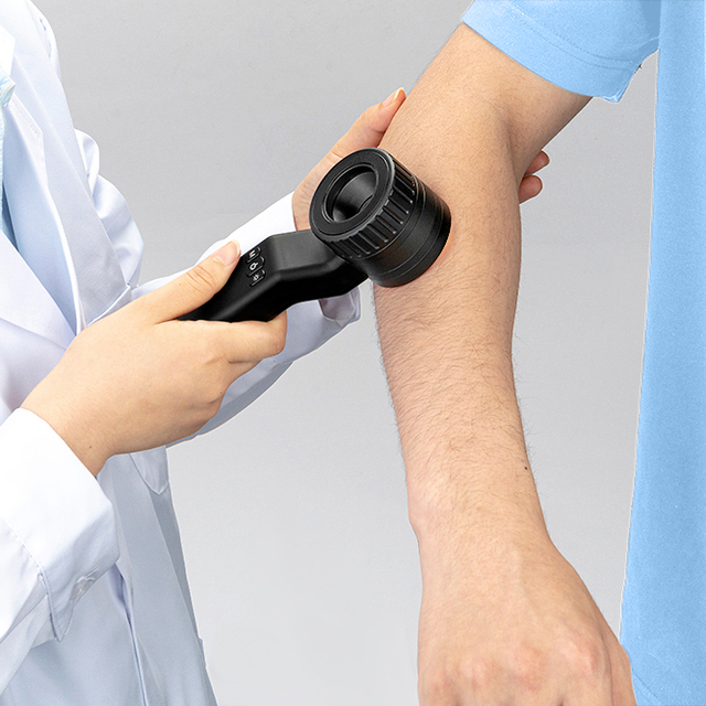 IBOOLO 2023 Hottest Design 10x Naked Eyes Dermatoscope Device for Hospital Dermatologist
