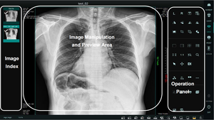 Máquina de Raio-X Diagnóstica Super Barata 2026, Detector de Painel Plano Sem Fio para Veterinários - Product Image 6