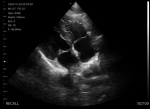 Sonde d'échographie vétérinaire sans fil portable, scanner cardiaque pour animaux, pour clinique - Product Image 5
