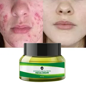 YF चाय के पेड़ के विरोधी दाना मुँहासे उपचार प्राकृतिक चेहरा क्रीम लोशन मुँहासे निशान सिकुड़ती। Pores को हटाने चेहरे की त्वचा की देखभाल क्रीम