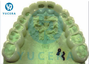 लचीला कृत्रिम दांतों सामग्री 16 रंग गुलाबी स्पष्ट दंत PMMA लचीला डिस्क - Product Image 6