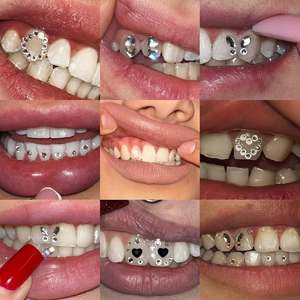 Ensemble de pierres précieuses pour dents en cristal transparent de couleur métallique en gros, kit de pierres précieuses pour dents avec lumière violette - Product Image 3