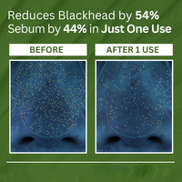 Masque à l'argile moussante à 13 % de PHA de marque privée avec basilic sacré et eau carbonatée |   Nettoyant en profondeur à l'oxygène coréen pour les points noirs et les pores