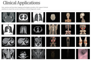 Escáner de Tomografía Computarizada Médico de Radiografía para Hospitales y Clínicas, Instalación Puerta a Puerta, Escáner de TC de 16/32/64/128 Cortes - Product Image 6