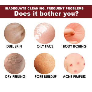 Vente en gros OEM éclaircissement de la peau visage blanchiment corps bain blanchiment élimination des taches brunes savon acide kojique - Product Image 6