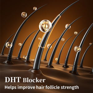 Özel etiket doğal bitkisel organik toptan kafa derisi Elixirs bakım kaybı tedavisi biberiye saç büyüme yağı Serum saç için - Product Image 5