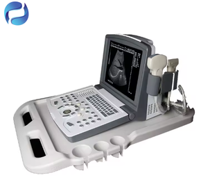 Échographe portable électrique pour grossesse, type ordinateur portable, pour cliniques, instruments d'échographie médicale avec garantie de <span class=keywords><strong>3</strong></span> ans - Product Image 4
