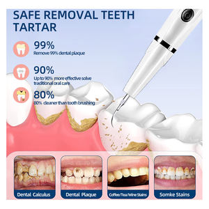 Scaler Dentale Portatile Multiuso Rimuovi-Tartaro e Macchie in Acciaio Inossidabile per Adulti - Product Image 6