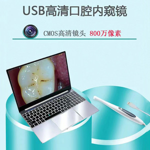 เครื่องมือส่องตรวจช่องปาก Meiliguang พร้อมการเชื่อมต่อ USB สำหรับการตรวจและตรวจสอบทางทันตกรรม - Product Image 5
