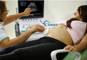 Ecógrafo Doppler Color Portátil al Mejor <span class=keywords><strong>Precio</strong></span>, con PDI, Dispositivo de Ultrasonido General para Diagnóstico Hospitalario, Ecografía CU09 - Product Image 2