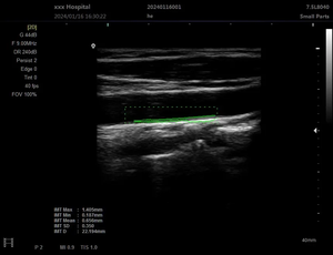 Dokter Hewan Laptop Ultrasound Doppler medis Sonar ecardiografi warna untuk Obstetri ginekologi Diagnosis anjing dapat digunakan kembali - Product Image 6