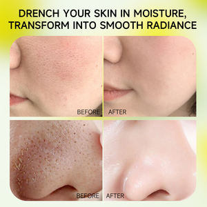 Cuidado de la piel para el acné y las marcas de viruela Extracto de planta vegana Tomate verde Crema facial Levantamiento de poros Mandarina verde Vita C Crema Para manchas oscuras - Product Image 4