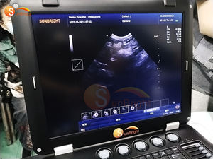 Ecógrafo Profesional para Animales de Granja SUN-906A, Doppler a Color de Alta Definición para Control de <span class=keywords><strong>Enfermedades</strong></span> - Product Image 3