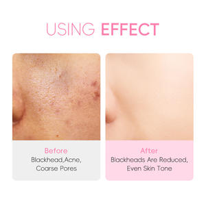 ครีมบำรุงผิวหน้าสูตรซากุระสำหรับกลางคืน ช่วยเติมความชุ่มชื้นอย่างล้ำลึก พร้อมกลิ่นหอมสดชื่น บำรุงผิวให้กระจ่างใส ลดเลือนริ้วรอย - Product Image 4