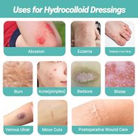 Rollo de Hidrocoloide Adhesivo Transparente de Grado Médico YOJO, Sin Látex, Amigable con la Piel, para Parches de Acné y Cuidado de Ampollas