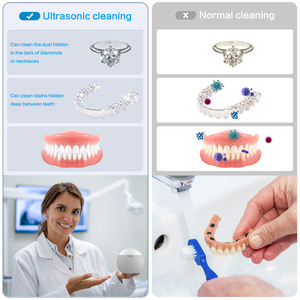 Ultrasonic Cleaner US100 210ML UV Denture <b>Toothbrush</b> <b>Heads</b> Cleaner for Braces Dental Care Household Use - Product Image 4